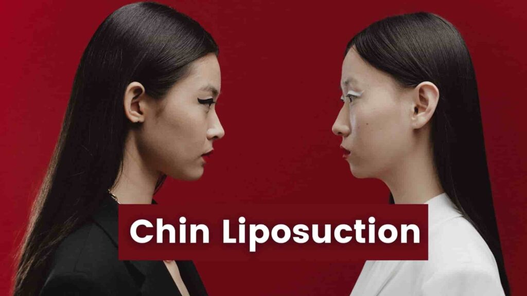 Chin Liposuction Cost In Different Countries | Complete Cost, Benefits