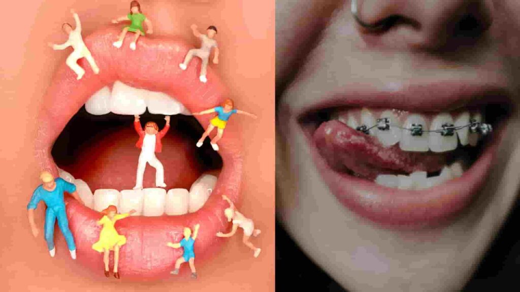 Baby Teeth In Adults, What To Do, How Long Do Baby Teeth Last In Adults