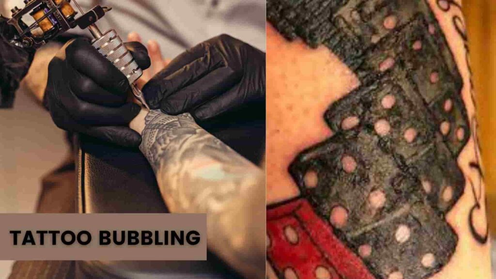 Tattoo Bubbling, What Cause Bubbling Tattoo, Infection, Skin Damage & Precaution